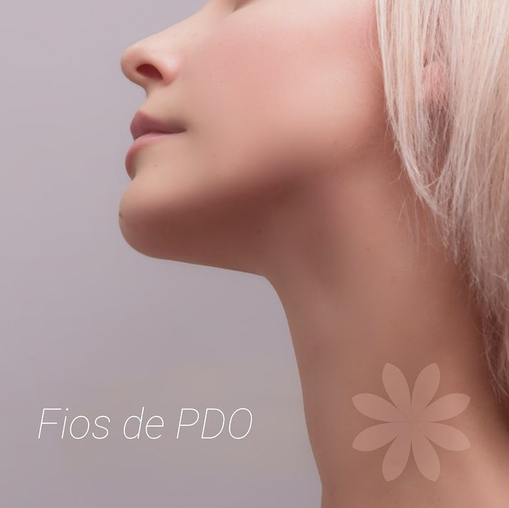 Fios de PDO