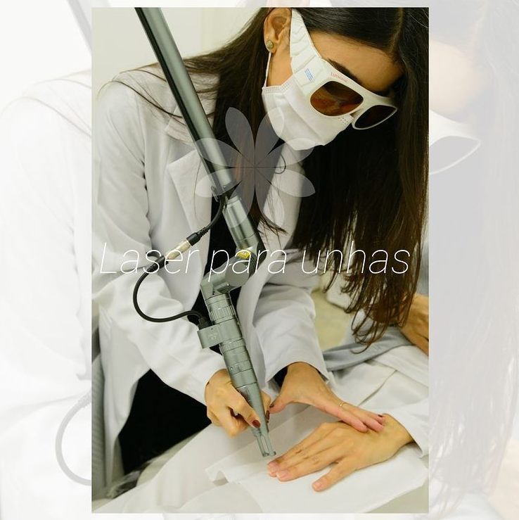 Laser para Unhas